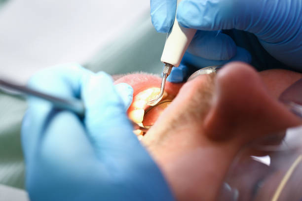 Best Emergency Cosmetic Dentistry (e.g., broken veneers) in Seville, OH